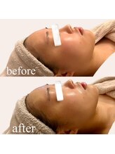 アズユウ(As U)/レストセルトリートメント