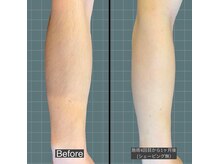 アレッド 大阪店(ared.)/半袖が待ち遠しい！