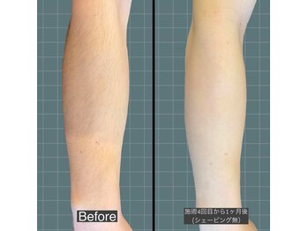 アレッド 大阪店(ared.)/半袖が待ち遠しい！