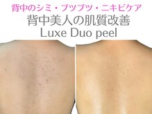 オリエンタルローザ 表参道(Oriental Rosa)の雰囲気（新登場！贅沢な2つのピーリングで即時効果！背中美人爆速誕生♪）