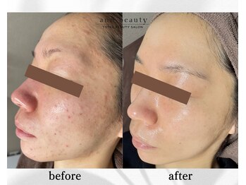 アン ビューティー(ann beauty)/定期的に通われてお客様