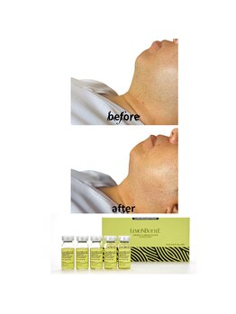 ブリリアントスマイル/話題のレモンボトル