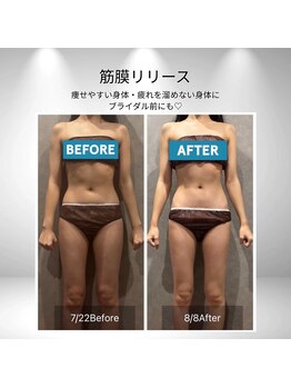 ロア ビューテ(loa beaut'e)/筋膜マッサージは即！効果実感♪