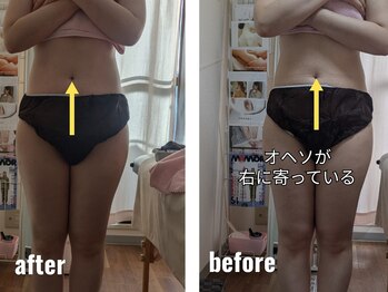 紬(TSUMUGI)/お腹のねじれは内臓不調に