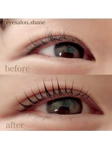 シェーン(shane)/ビフォーアフター