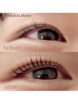 シェーン(shane)/ビフォーアフター