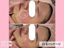 エンクリニカルラボ 京都駅前店(E&N CLINICAL LABO)/白玉パッケージ☆