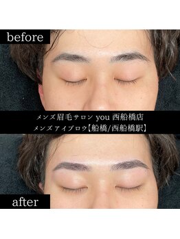 ユー 西船橋店(you)/ビフォーアフター写真
