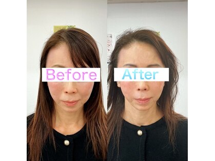 エスピーエー 桂坂(S.P.A)の写真