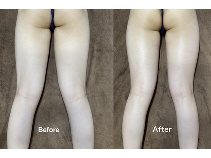 ハナ トータル ケア(Hana Total Care)の写真
