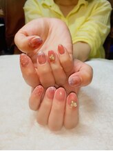 イリス(IRIS)/定額制シンプルコース