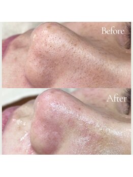 プアラ(puala)/ビフォーアフター