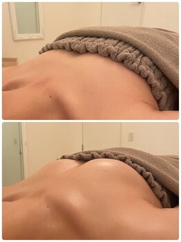 美人バスト 新宿店/☆姉妹店バストアップ症例写真☆