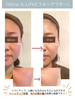 レイール(Reir)/ジーリフト