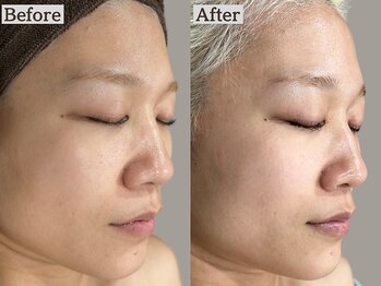 あすはれ/ララピール1回で白さ・ツヤ誕生!