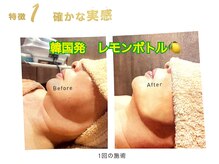 ボディスタイリング(Body Styling)の雰囲気（韓国初！脂肪分解レモンボトルでお顔のたるみを解決）