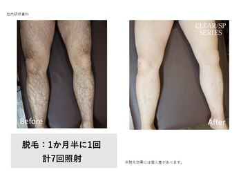 フェレザ 新潟(Felleza)/男性美容にも人気上昇中!