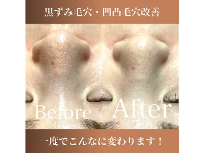 ベルダ(BELDAD)の写真