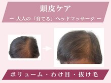 グリーンノート(GREEN NOTE)/【育毛】を促す頭皮ケア！