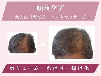 グリーンノート(GREEN NOTE)/【育毛】を促す頭皮ケア!