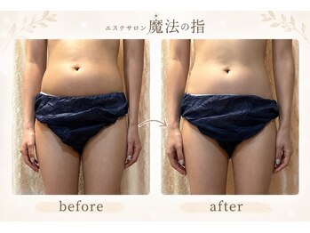 魔法の指の写真/リンパマッサージでボディが整う実感を。浮腫解消して代謝が上がるケアで軽やかな私に導く☆