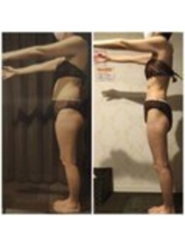 クイーン 天王寺店(Queen)/お客様 ビフォーアフター(2)