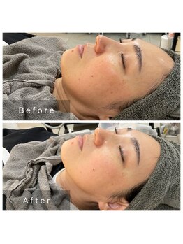 サロン ルイス アディクト(salon Lewis Addict)/