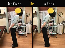 杉本接骨鍼灸院/若々しい背骨を取り戻す整体