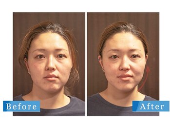 共立総合整骨院 八王子院/ビフォーアフター※個人差あり