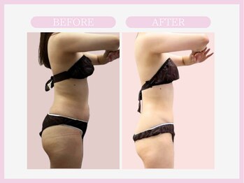 アコガレコガオ 山形店/