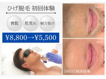 アデージョ アデオス(Ade-jyo.Adeosu)の雰囲気(脱毛/青髭/カミソリ負け◎満足していない脱毛お任せください♪)