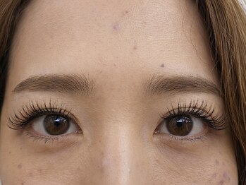 モルレーヴ(MOLREVE)/バインドロック