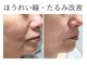 エボルブ 四条烏丸店(EVOLVE)の写真