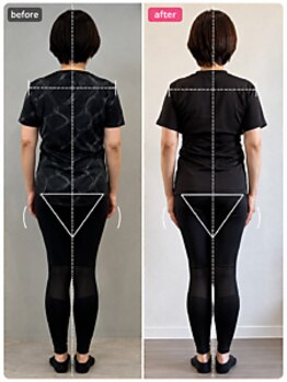 ホリック アイス コア ボディ(HOLIC ICE CORE BODY)/お客様ビフォーアフター4