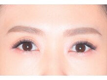 アイフラッシュ 阪急西宮ガーデンズ店(Eye Flash)/After