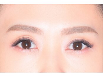 アイフラッシュ 阪急西宮ガーデンズ店(Eye Flash)/After