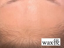 サロン ド ワカ(Salon de WAKA)/フェイシャルwax初回　施術後