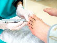 フットメンテ 巻き爪矯正センター 南浦和/グラインダーでのケア