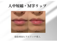 アールメディカルサロン 富山院(R Medical Salon)/可愛いM字リップ造形