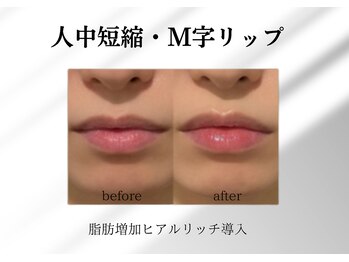 アールメディカルサロン 富山院(R Medical Salon)/可愛いM字リップ造形