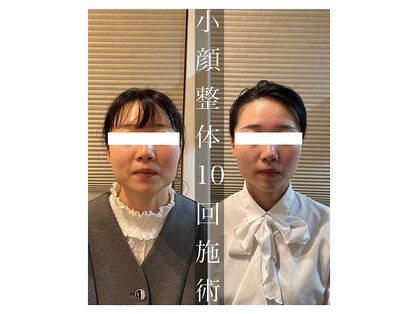 リファイン(Refine)の写真