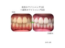 グロウ 東区香椎(GLOW)の雰囲気（芸能人級も！歯科提携セルフホワイトニングできる本格専門サロン）