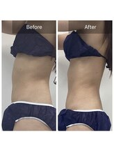 ダリア(Dahlia)/全身デトックス120分