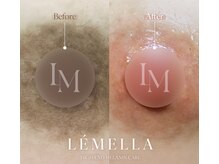 ラ リノ 星ヶ丘(La Lino)の雰囲気（黒ずみケアでお肌の本来の色へ！毛穴やハリにも効果あり♪）