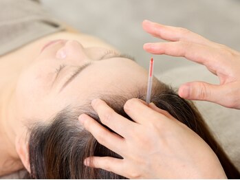 トゥルーカラーズの写真/不調だけでなく女性誰しもが求める”美容”も◎理想のシュッとした輪郭を叶えます！小顔/エイジングケア