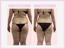 スリムライン 八戸店(The Slim Line)/before→after