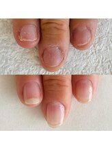 シーネイル(C Nail)/自爪育成、別人級に変化！