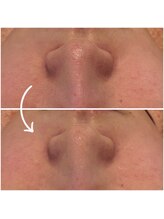 アイリーン(IRENE)/徹底毛穴ケア♪