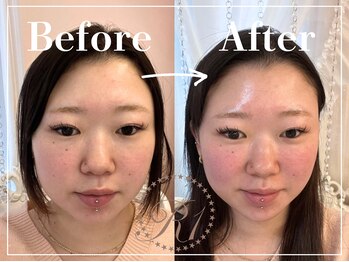 R-1ビューティーサロン 表参道/Before＆After