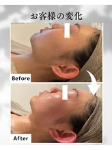 エムボーテ 太田店(M BEAUTE33)/顔筋小顔コルギ
